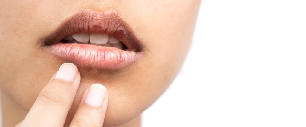 Is Dry Mouth A Symptom Of Covid