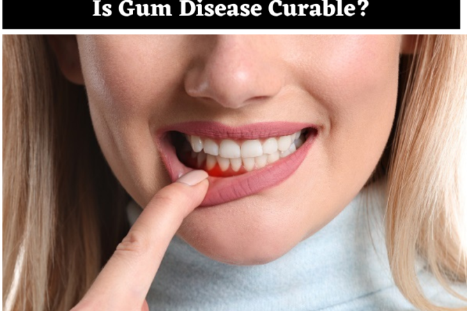 Gum Disease: Learn the Risk Factors & Habits to Improve Health