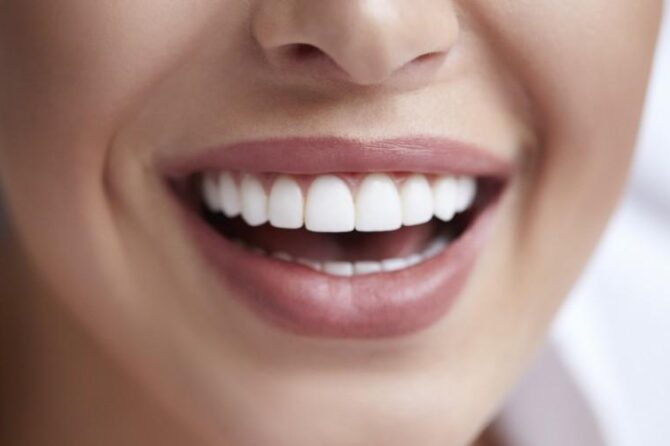 Smile Like a Star: Types of Dental Implants for Celebrities