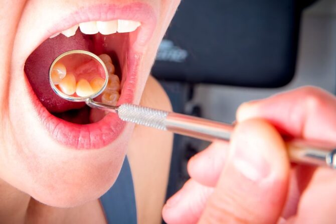 The Hidden Dangers of Gum Disease: All You Need to Know