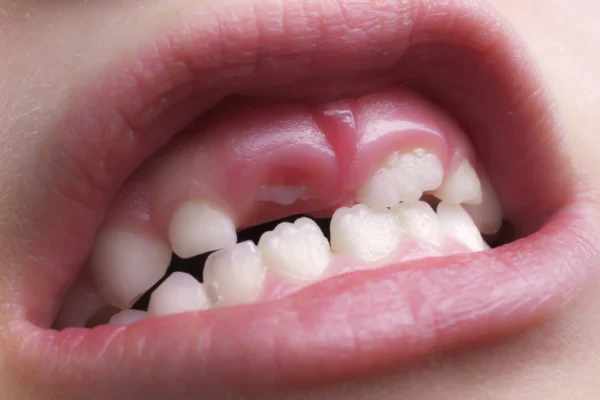 Regrow Teeth: Unlock the Secrets for Healthy Oral Care