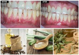 Natural ways to regrow gums