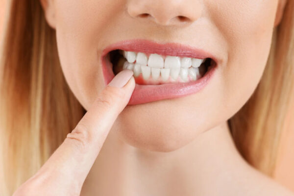 Don’t Let Gum Disease Ruin Your Smile- Gum Graft Cost With Insurance