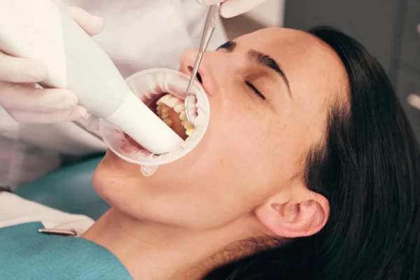 Do gums grow back after tartar removal? A Comprehensive Guide to Tartar Removal 